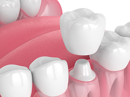 Vista Family Dental